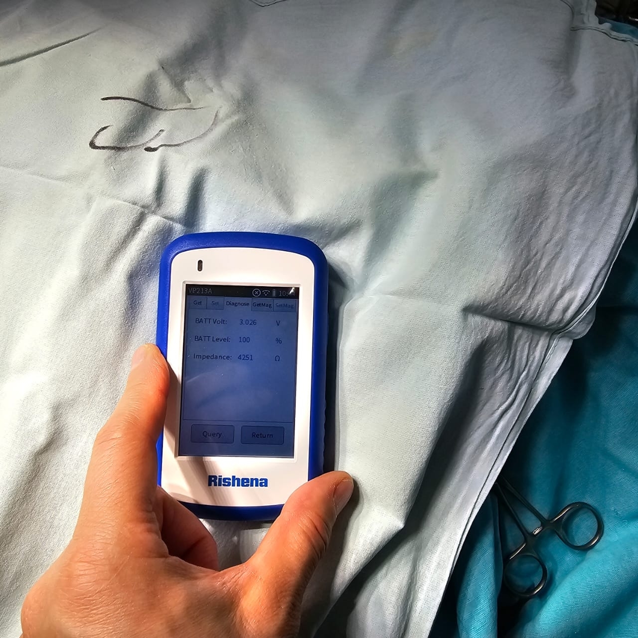 Врачи Университетской клиники ПИМУ первыми в России имплантировали пациенту с эпилепсией нейростимулятор блуждающего нерва нового поколения