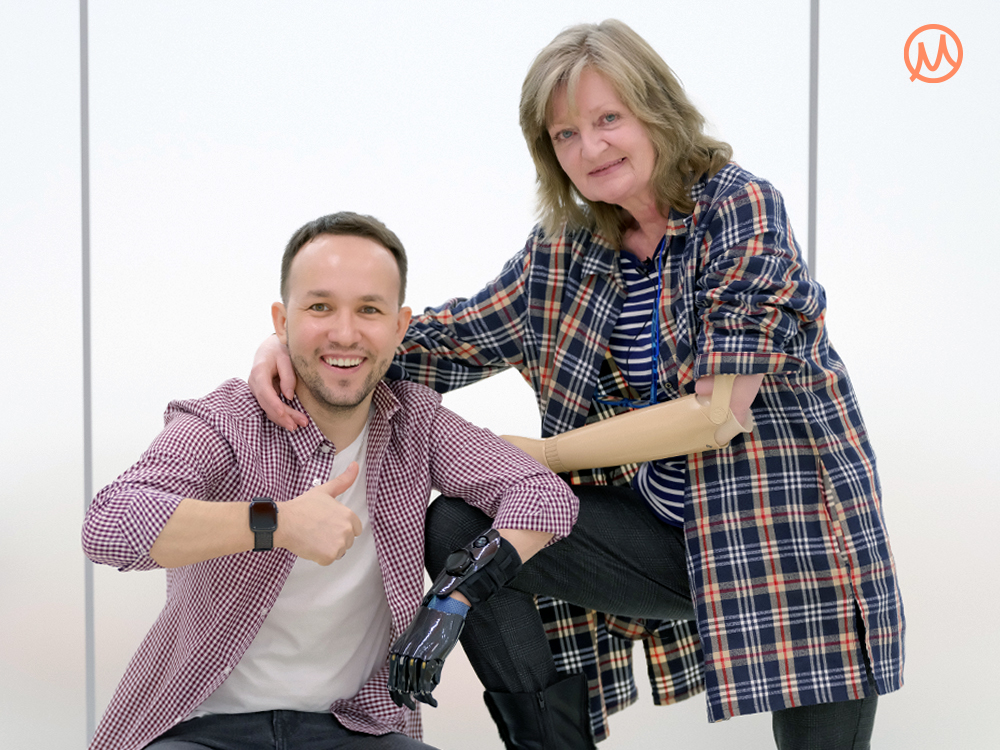 Обновила протез руки через 50 лет. Почему?