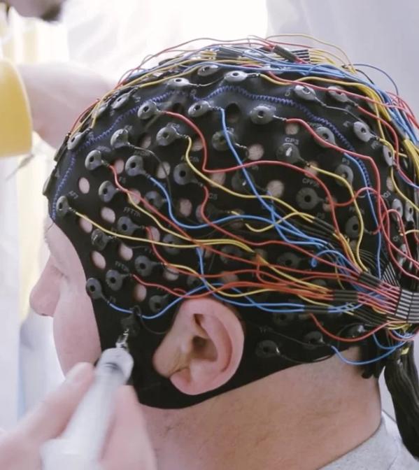 Инвазивная нейростимуляция