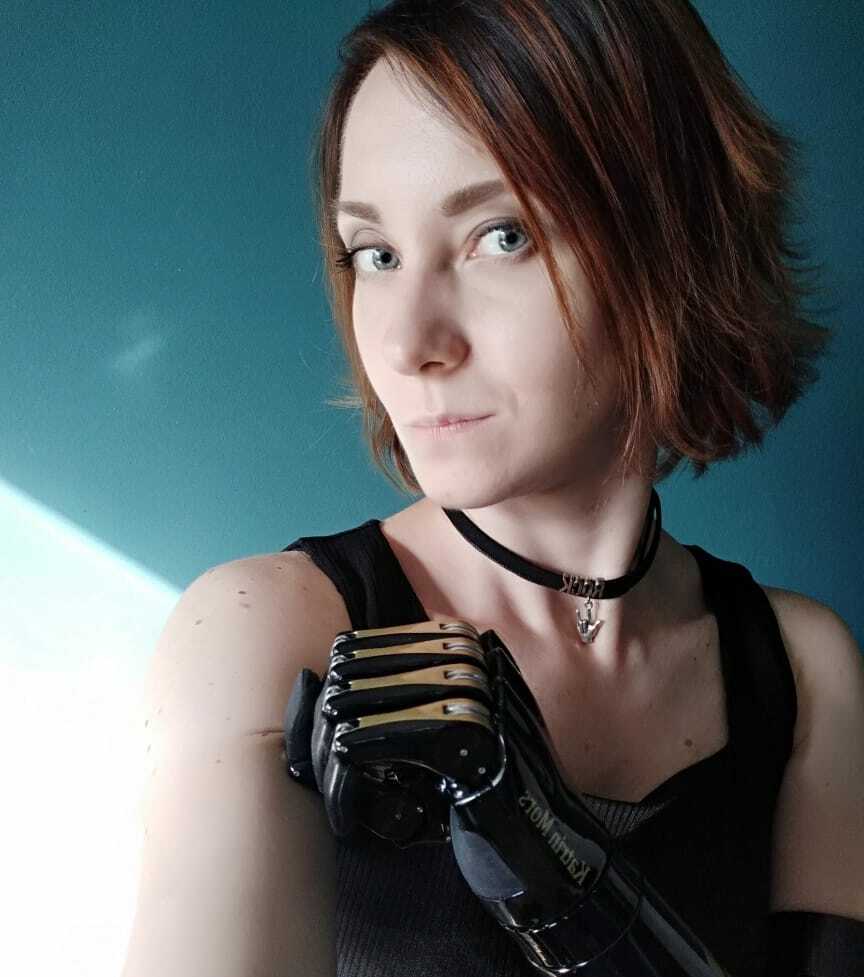 «Когда я ехала с протезом в автобусе, некоторые бабушки крестились»