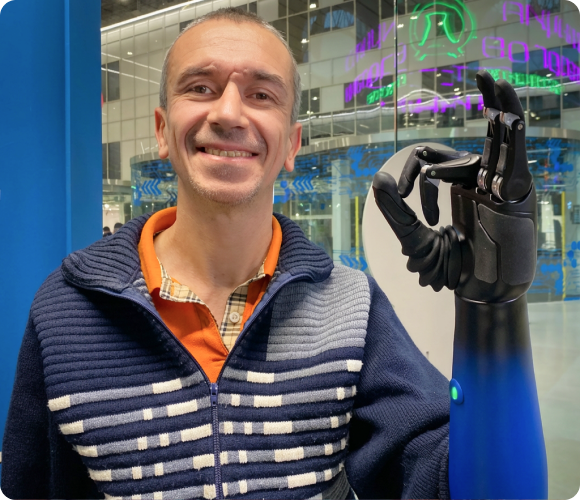 Пользователь протеза