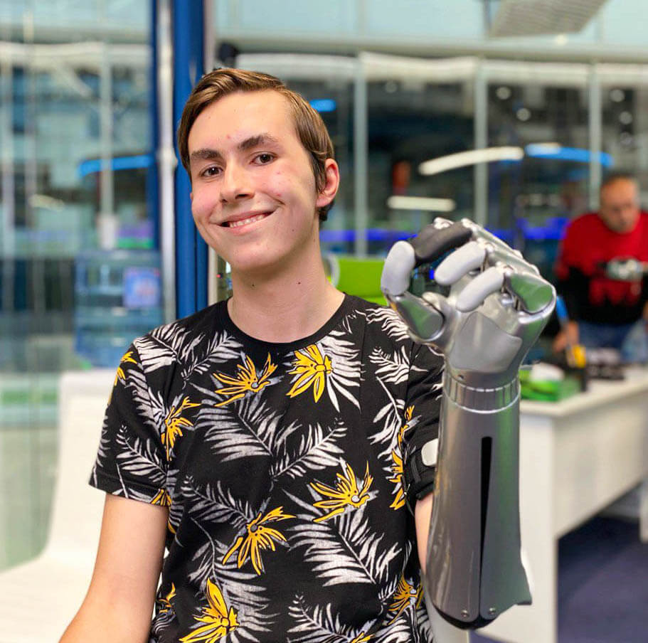 «Протез нужен, чтобы чувствовать себя в обществе уверенным, самостоятельным»