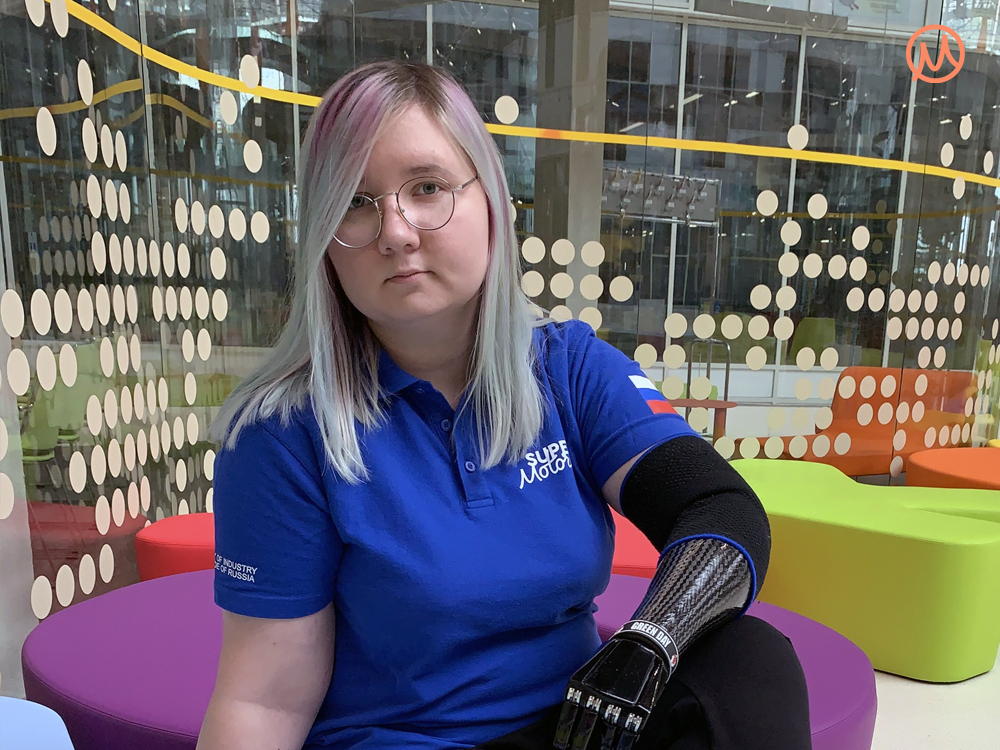 Элина с бионическим многосхватом из Москвы