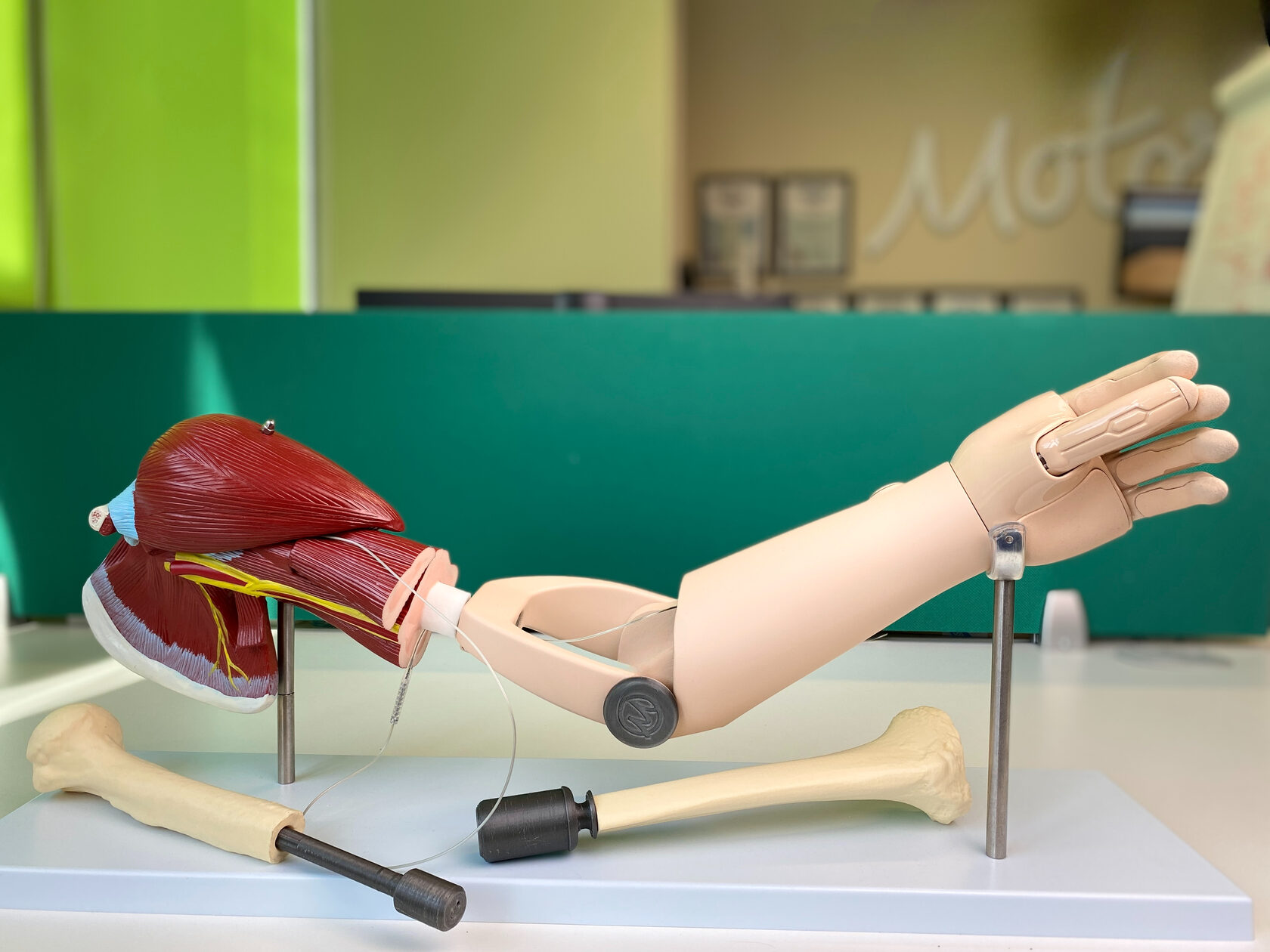 Российские ученые сделали важный шаг на пути к протезированию будущего: в России прошли первые успешные испытания остеоинтегрируемых протезов