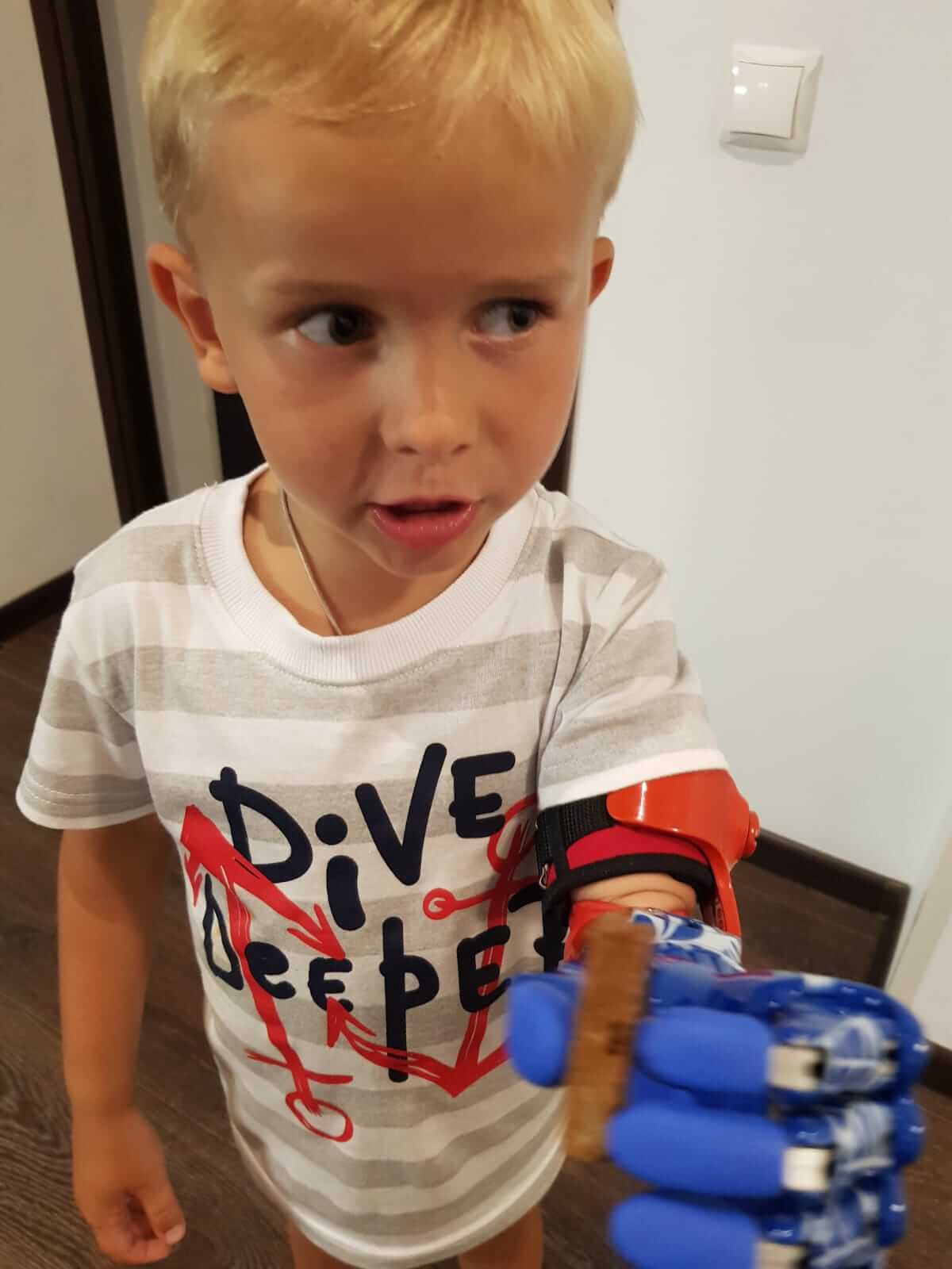 «Природа так распределила, забрала руку, но дала нас – родителей, которые тебя любят»