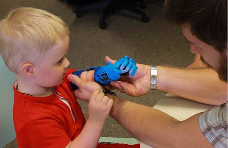 «У нас был косметический протез, это была «дубина», которую невозможно было носить»